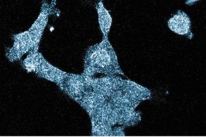 Immunofluorescence staining of A431cells (Human epithelial carcinoma, ATCC CRL-1555) with the mouse anti-GIT1 antibody. (GIT1 antibody  (AA 664-770))