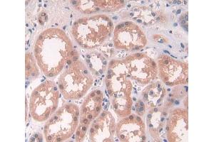 Figure. (ALAD antibody  (AA 1-330))