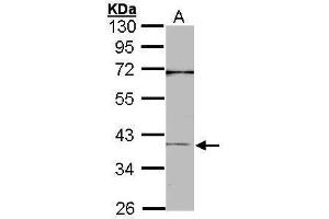 WB Image Sample (30 ug of whole cell lysate) A: A431 , 10% SDS PAGE antibody diluted at 1:1000 (CEBPB antibody  (N-Term))