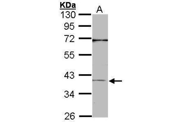 CEBPB antibody  (N-Term)