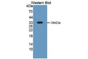 Western blot analysis of the recombinant protein. (ICK antibody  (AA 1-284))