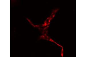 ABIN6274410 staining HepG2 cells by IF/ICC. (STRADA antibody  (Internal Region))