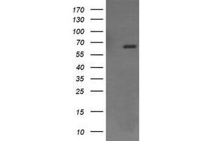 Image no. 1 for anti-Endoglin (ENG) antibody (ABIN1497150) (Endoglin antibody)