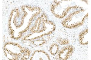 anti-Coatomer Protein Complex, Subunit beta 2 (COPB2) (AA 856-906) antibody