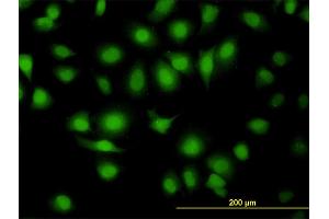 Immunofluorescence of monoclonal antibody to MAPK9 on HeLa cell. (JNK2 antibody  (AA 321-424))