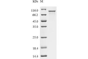 (Tris-Glycine gel) Discontinuous SDS-PAGE (reduced) with 5 % enrichment gel and 15 % separation gel.