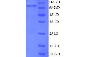 SDS-PAGE (SDS) image for E3 ubiquitin-protein ligase RAD18 (RAD18) (AA 1-495), (full length) protein (His-SUMO Tag) (ABIN5711931) (RAD18 Protein (AA 1-495, full length) (His-SUMO Tag))