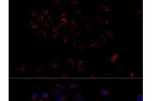 Immunofluorescence analysis of HeLa cells using ATP5B Polyclonal Antibody at dilution of 1:100 (40x lens). (ATP5B antibody)