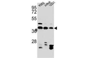 Western blot analysis of HNRNPC Antibody (C-term) in Jurkat,K562,U251 cell line lysates (35ug/lane). (HNRNPC antibody  (C-Term))