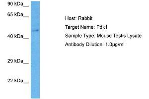 Host: Rabbit Target Name: PDK1 Sample Tissue: Mouse Testis Antibody Dilution: 1ug/ml (PDPK1 antibody  (Middle Region))