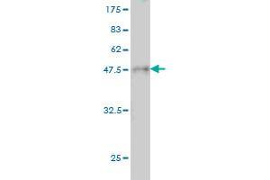 Western Blot detection against Immunogen (36. (RPSA/Laminin Receptor antibody  (AA 196-295))