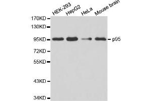 Western blot analysis of extracts of various cell lines, using NBN antibody (ABIN5970297). (Nibrin antibody)