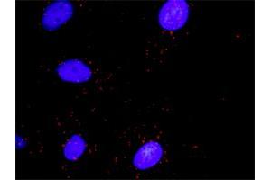 Proximity Ligation Analysis of protein-protein interactions between RHOA and DAAM1. (DAAM1 antibody  (AA 1-110))