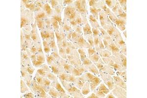 Immunohistochemistry of paraffin embedded mouse heart using Igfn1 (ABIN7074278) at dilution of 1:700 (400x lens) (IGFN1 antibody)