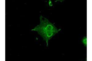 Anti-CRYAB mouse monoclonal antibody (ABIN2452606) immunofluorescent staining of COS7 cells transiently transfected by pCMV6-ENTRY CRYAB (RC202718). (CRYAB antibody)