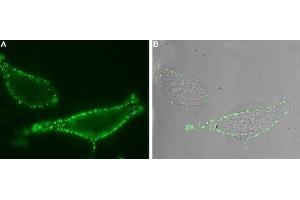 Expression of TRPV6 in human LNCaP cells - Cell surface detection of TRPV6 in intact living human prostate carcinoma (LNCaP) cells. (TRPV6 antibody  (1st Extracellular Loop))