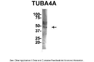IP Suggested Anti-TUBA4A Antibody Positive Control: NT2 CELL/BRAIN TISSUE (TUBA4A antibody  (Middle Region))