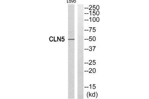 Western Blotting (WB) image for anti-Ceroid-Lipofuscinosis, Neuronal 5 (CLN5) (Internal Region) antibody (ABIN1851078)