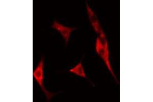 ABIN6274760 staining A549 cells by IF/ICC. (RPS8 antibody  (C-Term))