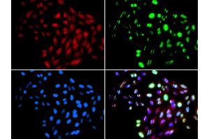 Immunofluorescence analysis of GFP-RNF168 trangenic U2OS cell using RAD51B antibody. (RAD51 Homolog B antibody)