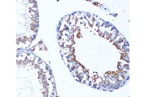 Immunohistochemistry of paraffin-embedded Mouse testis using MAP1LC3A Polyclonal Antibody at dilution of 1:100 (20x lens). (MAP1LC3A antibody)