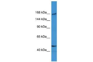 WB Suggested Anti-BTBD12 Antibody Titration: 0. (BTBD12 antibody  (N-Term))