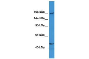 WB Suggested Anti-BTBD12 Antibody Titration: 0.