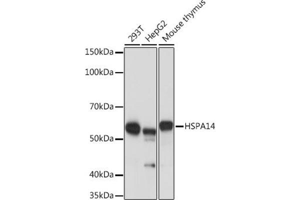HSPA14 抗体