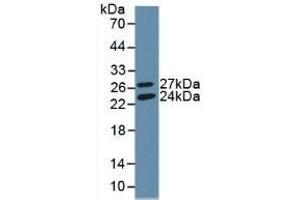 Detection of Recombinant GSS, Human using Polyclonal Antibody to Glutathione Synthetase (GSS) (Glutathione Synthetase antibody  (AA 268-474))