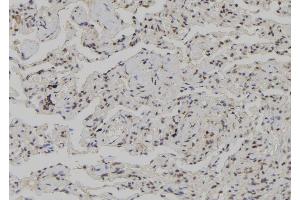 ABIN6272611 at 1/100 staining Human lung tissue by IHC-P. (CSNK1G3 antibody  (N-Term))
