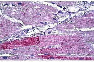 Human Heart: Formalin-Fixed, Paraffin-Embedded (FFPE) (PKD2 antibody  (AA 829-878))