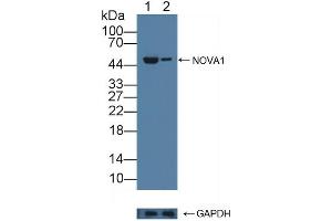 anti-Neuro-Oncological Ventral Antigen 1 (NOVA1) (AA 295-510) antibody