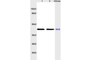 L1 rat heart, L2 rat brain lysates probed (ABIN728743) at 1:200 in 4 °C. (PAR1 antibody  (AA 251-350))