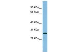 Image no. 1 for anti-Ribosomal Protein L10a (RPL10A) (AA 107-156) antibody (ABIN6745123) (RPL10A antibody  (AA 107-156))