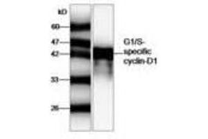 Image no. 1 for anti-Cyclin D1 (CCND1) antibody (ABIN791463) (Cyclin D1 antibody)