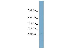 WB Suggested Anti-NOLA3 Antibody Titration: 0. (Nop10 antibody  (Middle Region))