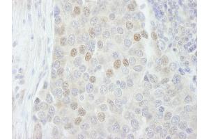 Immunohistochemistry (IHC) image for anti-RNA Binding Motif Protein 27 (RBM27) (AA 700-750) antibody (ABIN7448764) (RBM27 antibody  (AA 700-750))