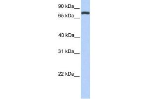 WB Suggested Anti-COLEC12 Antibody Titration:  0. (COLEC12 antibody  (Middle Region))