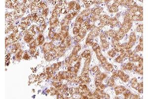 ABIN6268827 at 1/100 staining human liver tissue sections by IHC-P. (CXCR4 antibody  (C-Term))