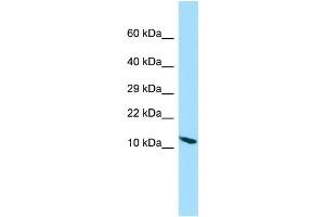 WB Suggested Anti-PPP1R14D Antibody Titration: 1. (PPP1R14D antibody  (N-Term))