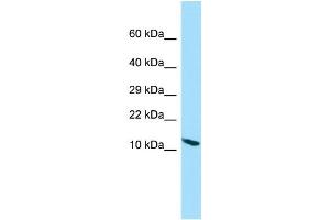 WB Suggested Anti-PPP1R14D Antibody Titration: 1.