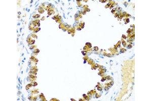 Immunohistochemistry of paraffin-embedded Mouse lung using NRG4 Polyclonal Antibody at dilution of 1:100 (40x lens). (Neuregulin 4 antibody)