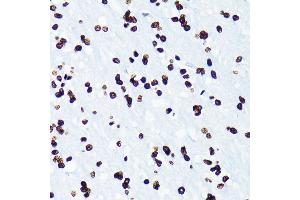 Immunohistochemistry of paraffin-embedded rat brain using Acetyl-Histone H4-K5 antibody (ABIN7267743) at dilution of 1:100 (40x lens). (Histone H4 antibody  (acLys5))