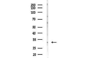 anti-Achaete-Scute Complex Homolog 1 (Drosophila) (ASCL1) (C-Term) antibody