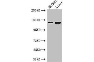 Western Blot Positive WB detected in: HEK293 whole cell lysate, Mouse liver tissue All lanes: PDGFRA antibody at 3 μg/mL Secondary Goat polyclonal to rabbit IgG at 1/50000 dilution Predicted band size: 123, 25, 83 kDa Observed band size: 123 kDa (PDGFRA antibody  (AA 30-198))