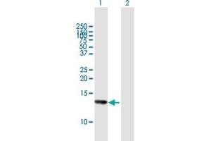Western Blot analysis of HCP5 expression in transfected 293T cell line by HCP5 MaxPab polyclonal antibody.