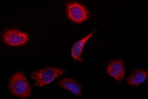 ABIN6263233 and ABIN6272850 staining Hela by IF/ICC. (MFF antibody  (Internal Region))