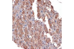 Immunohistochemistry of paraffin-embedded human liver using Apolipoprotein C3 Rabbit mAb (ABIN7265640) at dilution of 1:100 (40x lens). (APOC3 antibody)