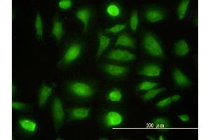 Immunofluorescence of monoclonal antibody to NPEPL1 on HeLa cell. (NPEPL1 antibody  (AA 1-523))