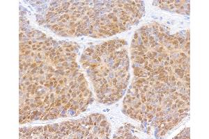 Immunohistochemistry (IHC) image for anti-SMAD, Mothers Against DPP Homolog 2 (SMAD2) (AA 225-275) antibody (ABIN7454016) (Recombinant SMAD2 antibody  (AA 225-275))